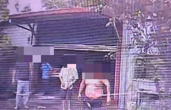 影/端午連假烤肉遭閃燃火吻　桃園男上半身45%2度燒燙傷