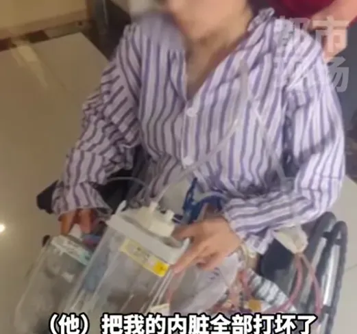 影/婚後遭狠夫家暴16次　孕妻因1動作被打到「臟器受損、終身攜便袋」