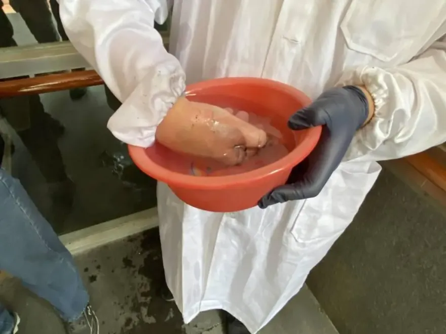 傷勢畫面曝光！台大生「化學實驗」失誤　氫化鋁鋰碰水灼傷手臂