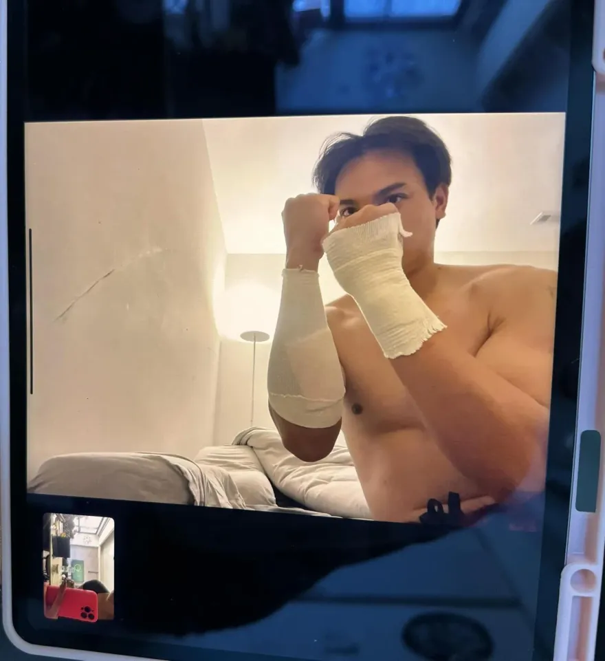 挨觸身球無礙！張育成PO「紗布包紮圖」幽默回應：秒變拳擊手