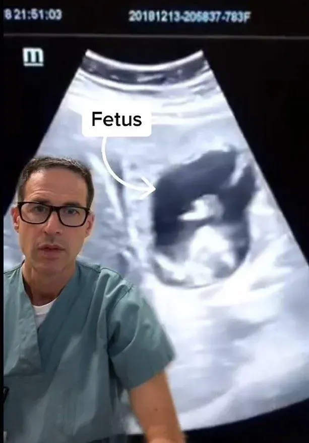 稀奇！33歲女腹痛停經卻出血　竟是「胎兒在肝臟」　全球文獻僅31例