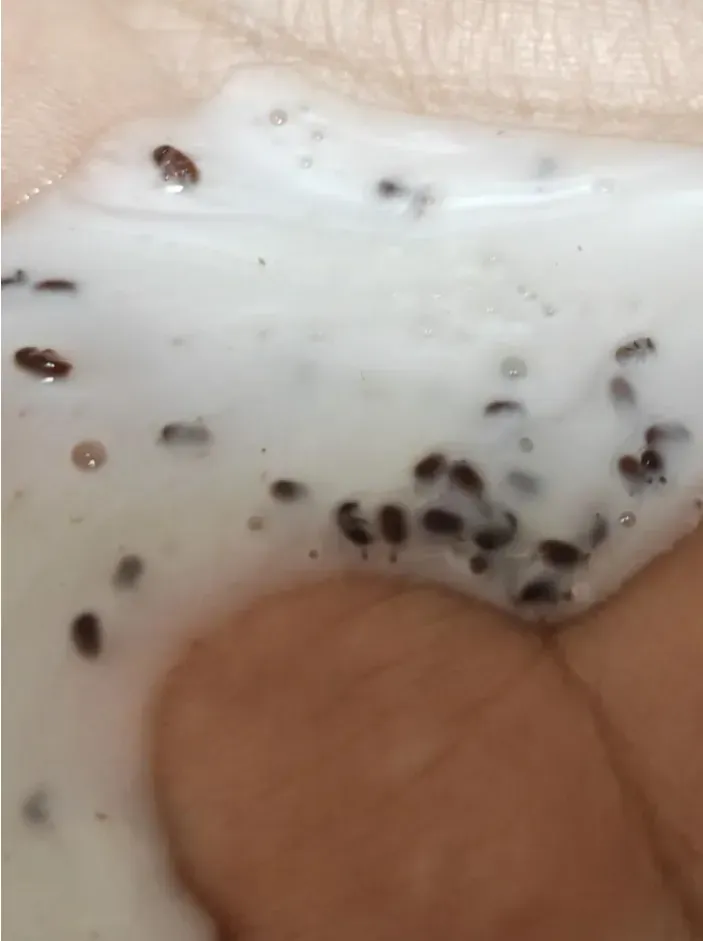 陸知名洗髮精一壓擠出「50多隻蟲卵」　她近看崩潰：有頭有腳像蟑螂卵