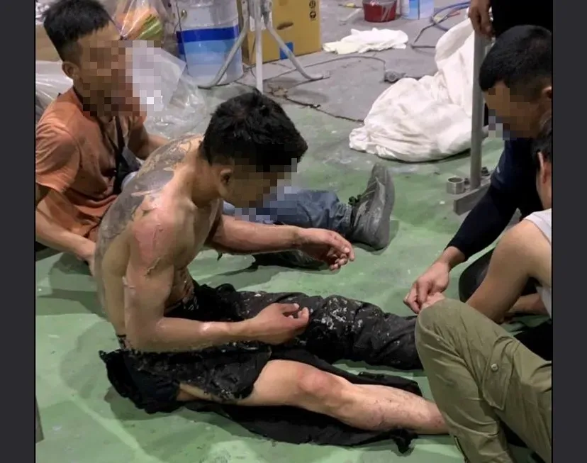 爆料找中天/宜蘭龍德造船廠出意外！3移工燙傷「皮膚黏衣服」喊好痛　他控主管延遲送醫