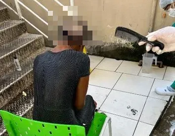 女街友頭皮遭蛆啃食！蟲蟲大軍「咬住一塊大洞」還見頭骨　醫師：送精神科