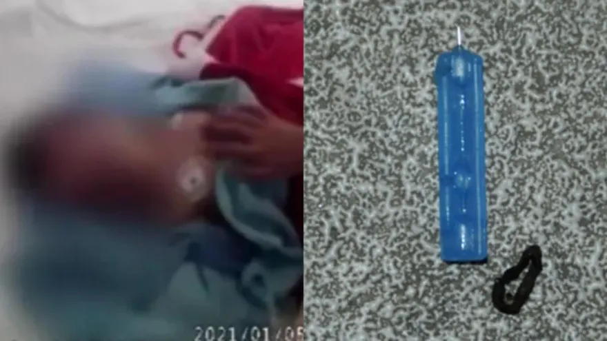 影/女博士誤信邪教「夜叉鬼附身」　致11個月兒「全身505個針眼」遭虐死