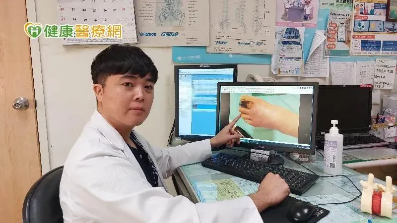 別輕忽海洋弧菌！70歲婦出國渡假感染截趾保命