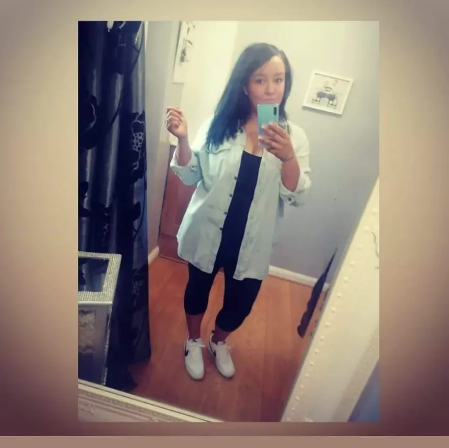 4寶媽減肥「切胃」失敗齒爛、掉髮！18個月後多重器官衰竭亡