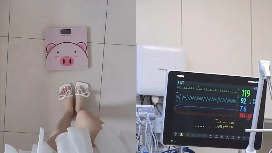 從57公斤瘦到34公斤！只因男友一句話　她瘋狂減肥患厭食症險丟小命