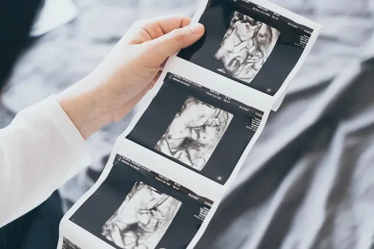 噴香水、塗指甲油不利排卵且傷精子！速食、加工食品易致流產