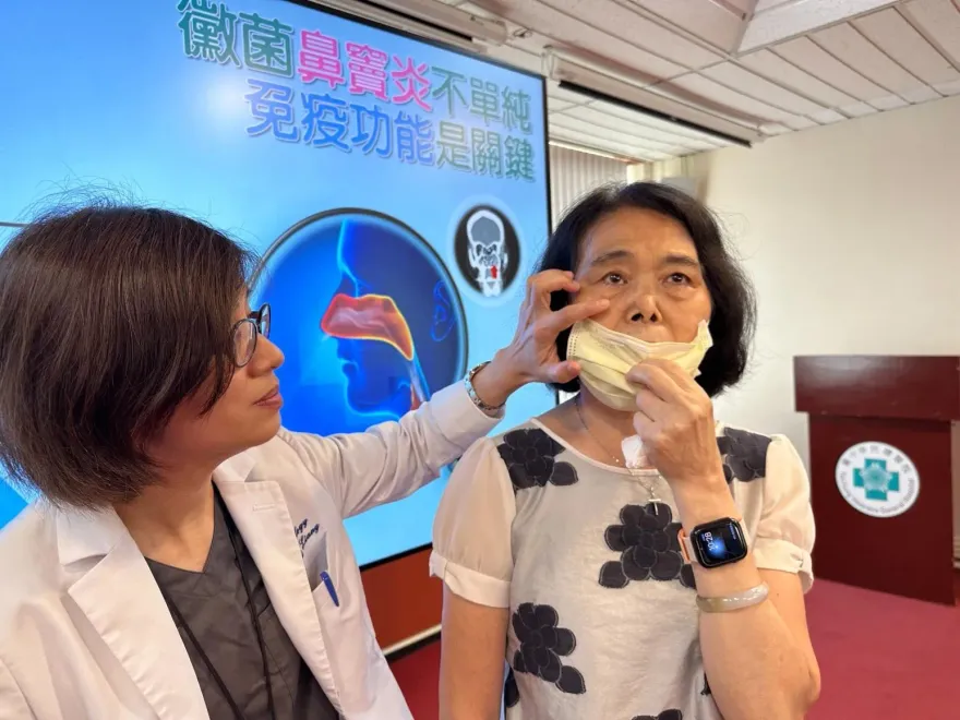 她「黴菌鼻竇炎」影響視力　醫：「免疫功能失衡」嚴重併發症恐致死！