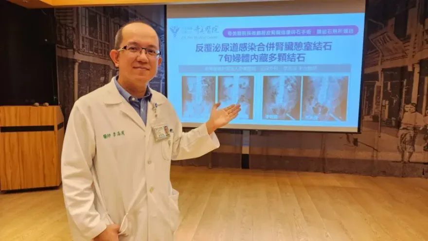 7旬婦反覆泌尿道感染、血尿合併腎結石！採「碎石手術」恢復健康