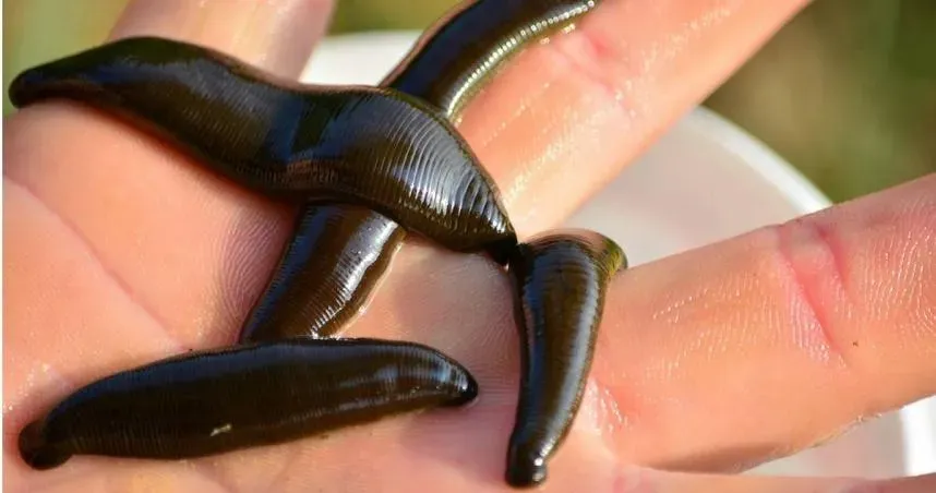 6旬婦不明原因咳半個月還帶血！赴醫發現「8公分水蛭」在氣管內