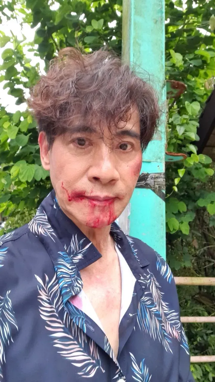 翁家明遭綁狼狽挨揍　滿臉是「血」畫面曝光！