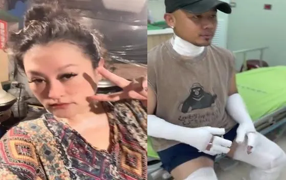 紀曉君擺攤遇氣爆「老公二度燒傷」　深夜淚崩喊：無法承受