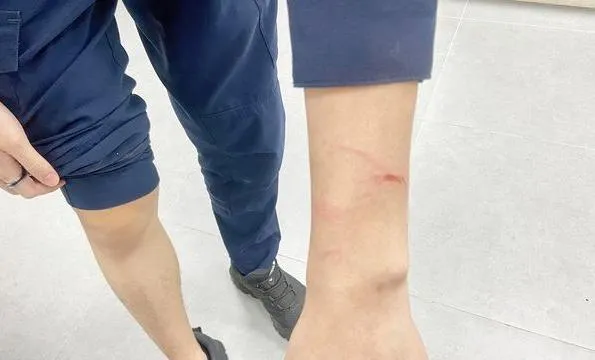 桃園逆子酒後砍父又咬傷員警　4罪名起訴