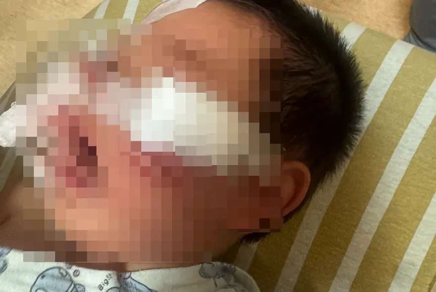 影/嘉義1歲童宮廟吃平安宴遭黑狗瘋咬　臉部嚴重撕裂傷