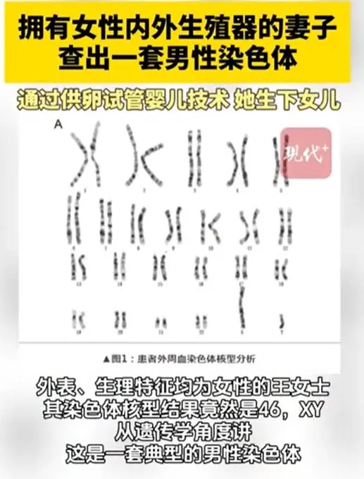 陸女婚後不孕以為月經不調竟查出男性XY染色體！經試管成功產女