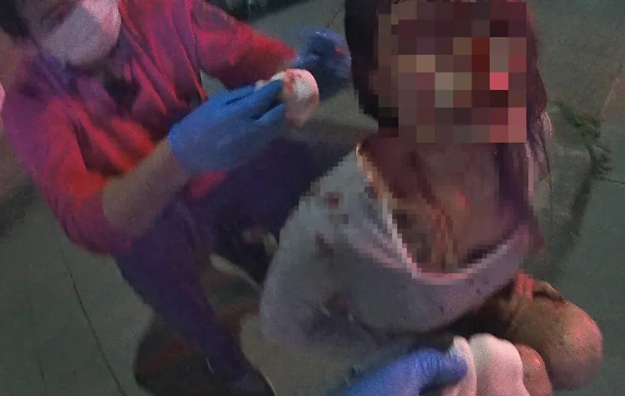 影/嘉義自撞車頭全毀3傷　後座19歲正妹頭破滿臉血