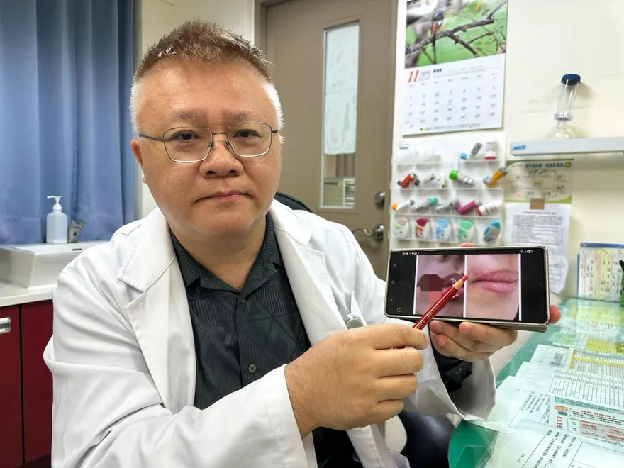 她臉部遭愛犬撕裂4公分險毀容　靠「PRP療法」修復