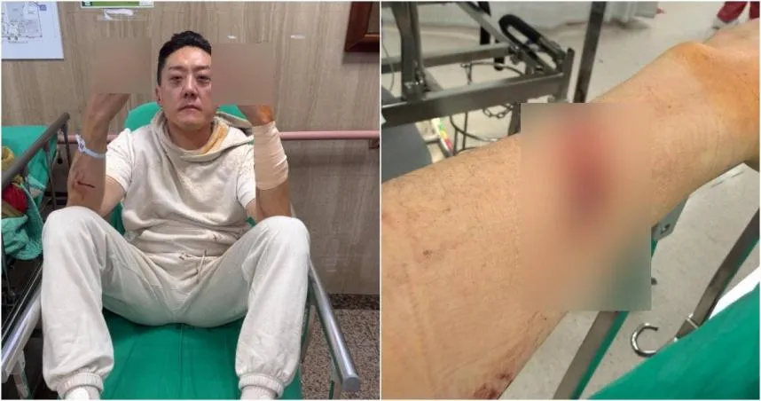 遭砍傷送醫　「夜店大亨」夏天倫曝實情：為朋友擋一刀