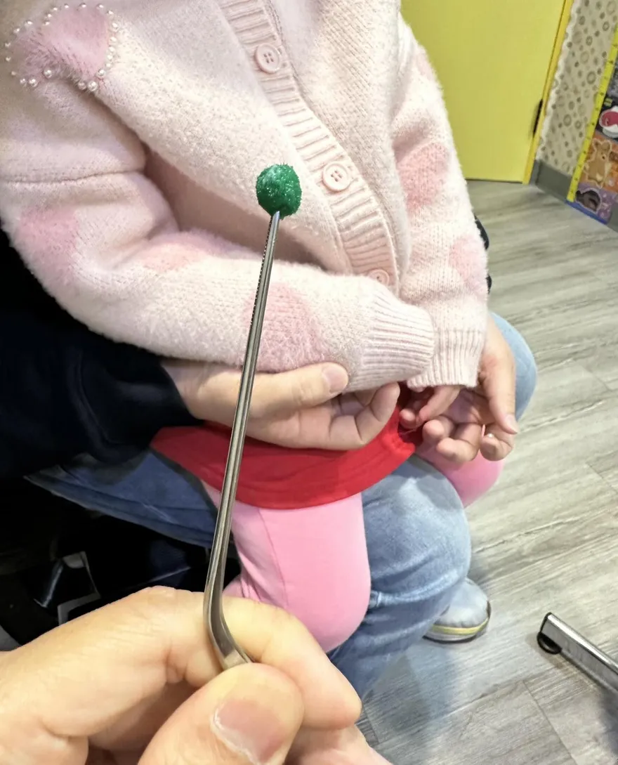 女孩把「聖誕毛球」塞進鼻孔　醫示警：千萬別自己挖！
