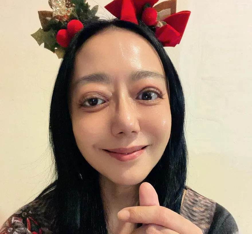 高慧君罹罕見眼疾險失明　勇敢曝近況：剩最後1次手術