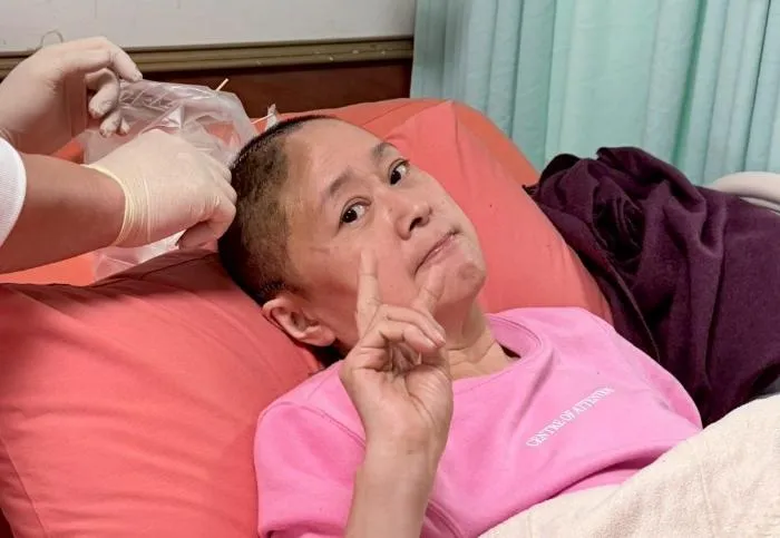 王月跌倒撞頭！緊急開顱手術昏迷5天　部分頭蓋骨遭移除