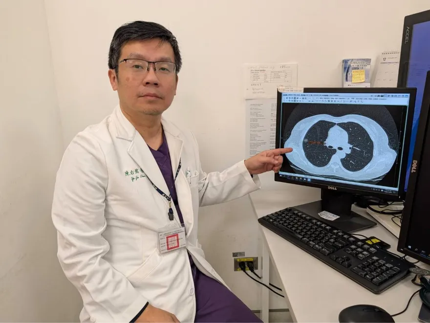 母親確診肺癌...2女兒篩檢竟也中鏢　醫：家族史超關鍵！