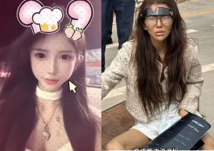 現況曝！陸正妹網紅被高薪誘騙至柬　「雙腿骨折」流落街頭獲救