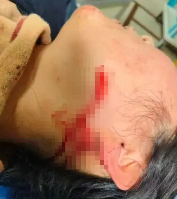 休假帶兒逛街遇歹徒！陸女警「空手奪白刃」頸動脈險遭刺穿