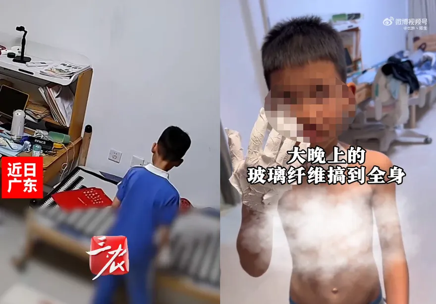 家長注意！陸男童好奇玩「滅火毯」　全身被扎滿超細玻璃纖維