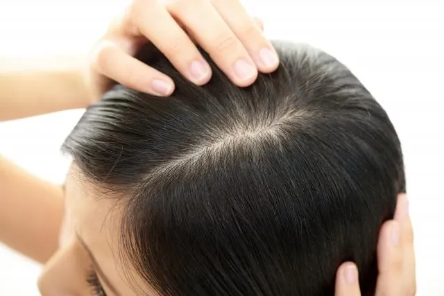 頭油味超扣分！「洗越多次越乾淨」反讓皮脂腺加速分泌