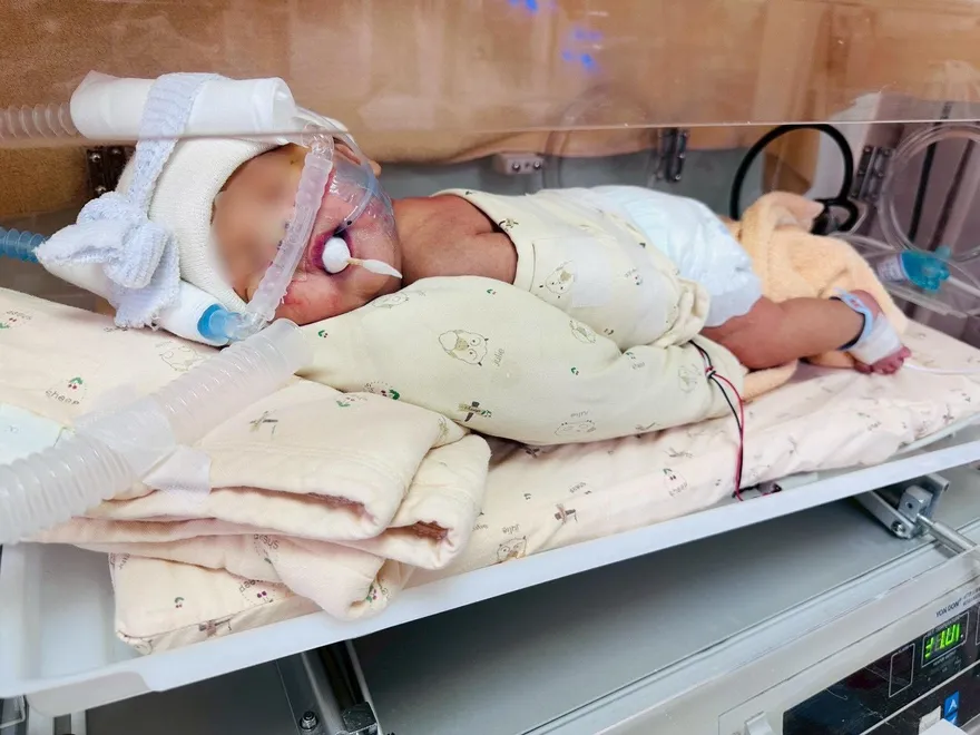 男嬰出生只哭兩聲就沒動靜！搶救第6天拔管順利出院