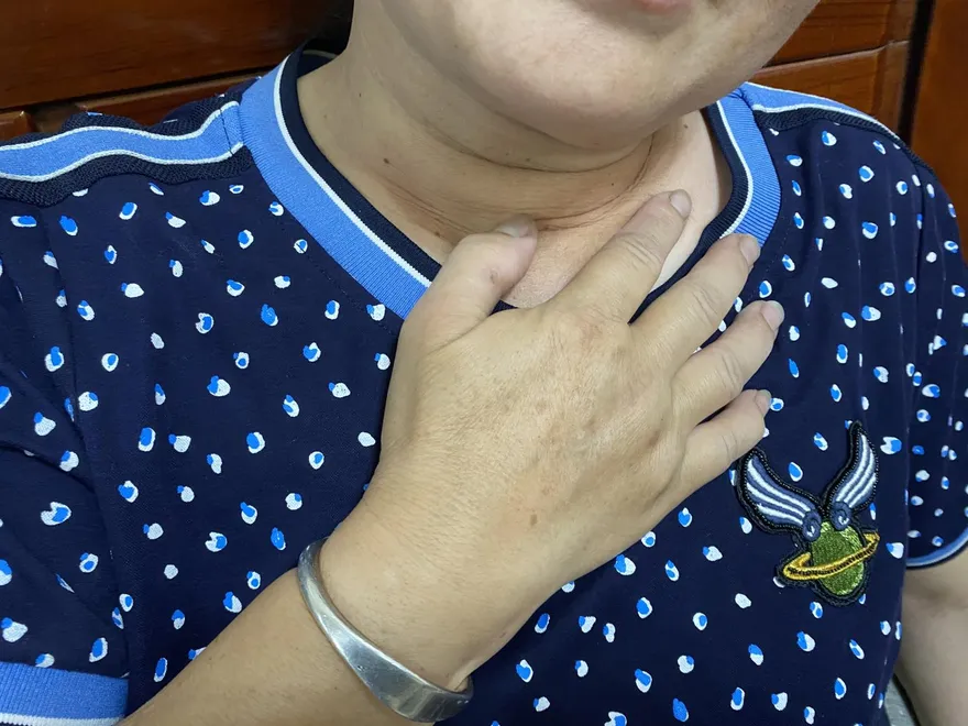 不喝酒也會得食道癌！醫：吞嚥卡卡確診多已是中晚期