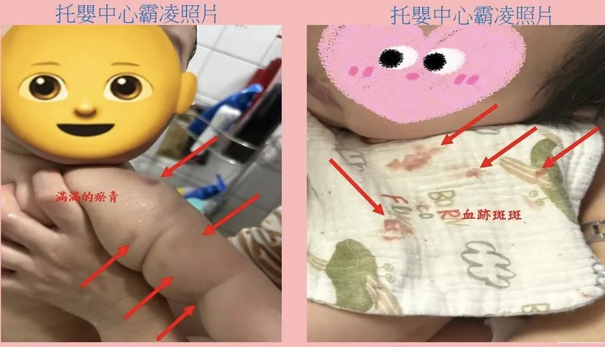 嘉義托嬰中心人員虐待6幼兒　市府祭出重罰