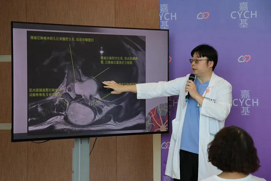飽受背痛折磨12年！41歲女跨三科精準「拆彈」成功
