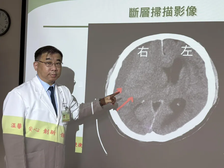 6旬水果攤老闆「手腳沒力」以為太累　竟是亞急性腦出血