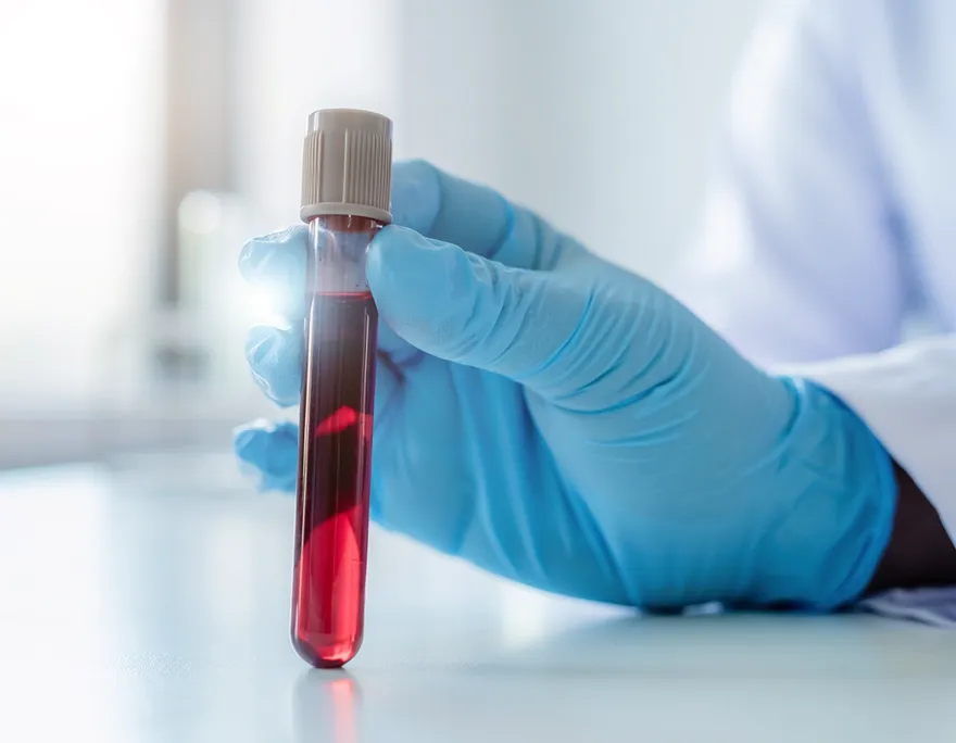 一管血揪50種癌！「全球首款」多癌種血檢叩關FDA