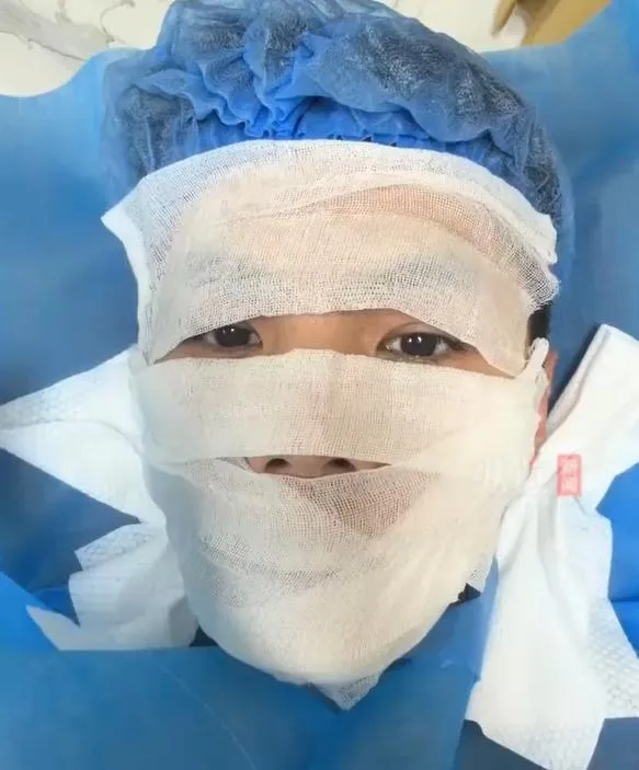 健身房重訓後徒手擦汗...陸男真菌感染患「香港臉」