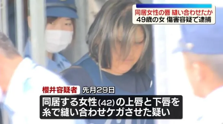日茨城驚傳恐怖虐待案！女子嘴唇遭縫合　逃至商店持紙條求救