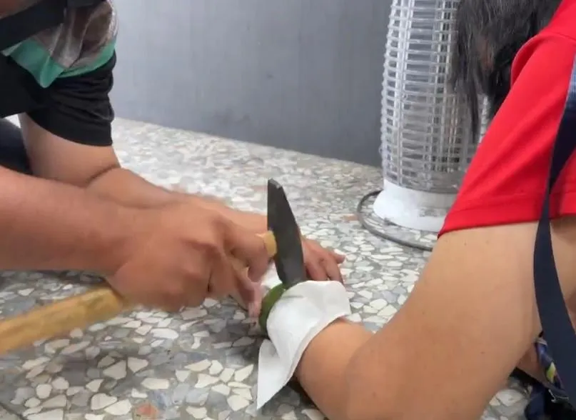影/車禍手腫脹玉鐲陷皮肉　消防鐵槌一敲化解危機