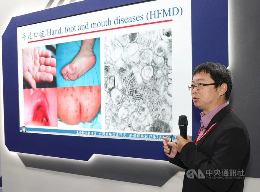 台灣自製腸病毒疫苗打入國際　搶下越南、澳門藥證
