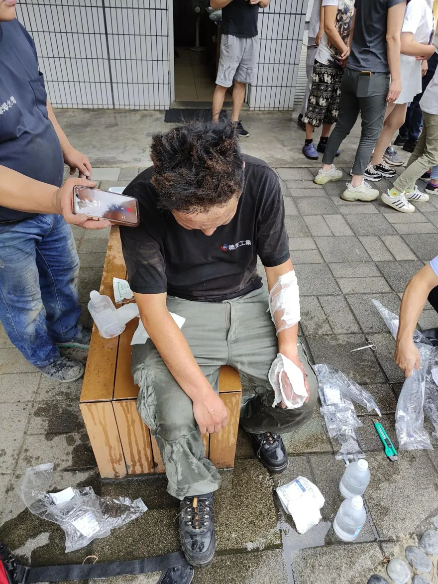 屏東高爾夫球具廠大爆炸／雞尾酒式多模止痛療法　傷燙傷患可有效止痛