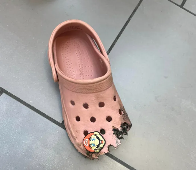 女童穿洞洞鞋搭手扶梯　鞋頭慘遭捲入「整截斷掉」