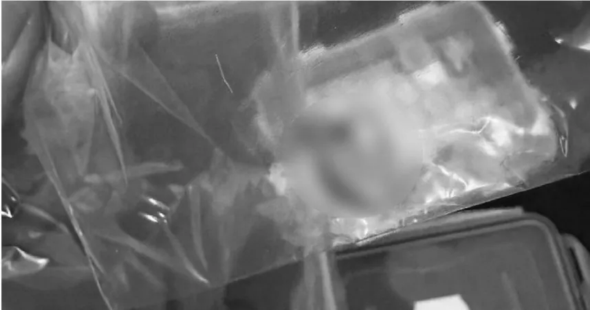 女騎士自撞無事返家...清理現場卻見「詭異斷指」！　里長嘆：接不回了