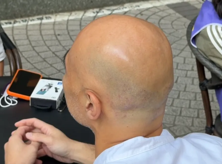 黃聖淇以光頭造型示人，大方分享他曾購買吹風機時看到店員的有趣反應。（圖／中天新聞）
