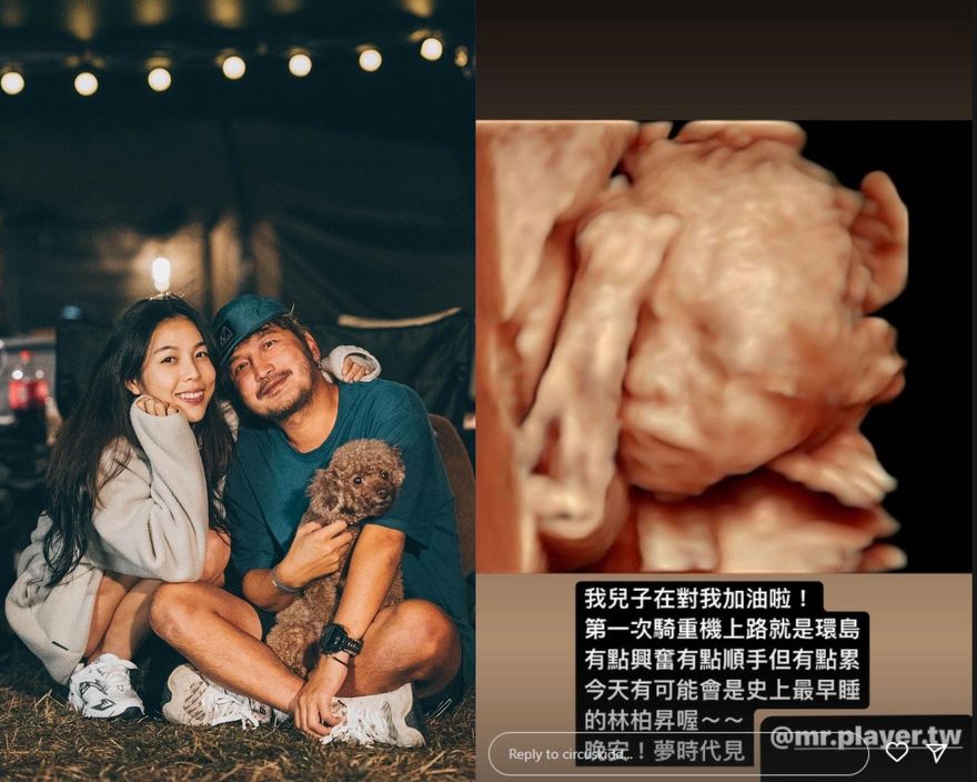 KID幸福曬「寶寶超音波照」！他見「這動作」笑了：兒子在對我加油啦~