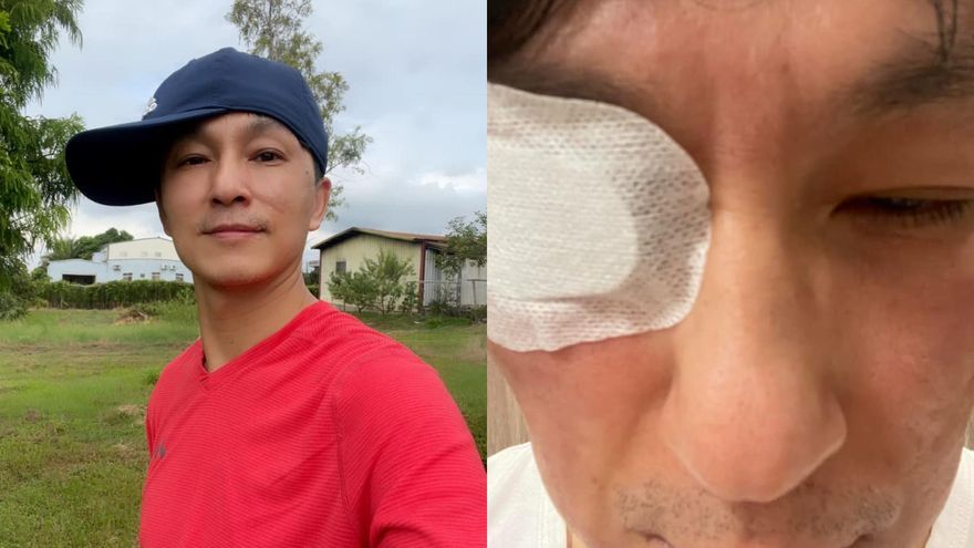 誤把「殺菌頭皮藥水」滴入眼！男星爆痛就醫「角膜慘遭灼傷」　驚悚傷勢照曝