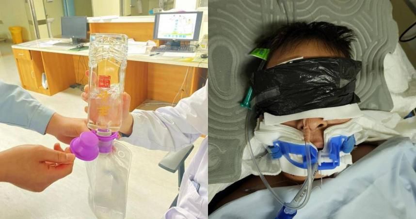 這招學起來！誤喝假酒命危…醫生用「真白酒」灌進他體內成功解毒