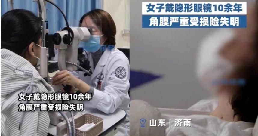 她戴隱眼10年出現「這症狀」！一檢查完了…視力剩0.1　眼角膜慘變灰白
